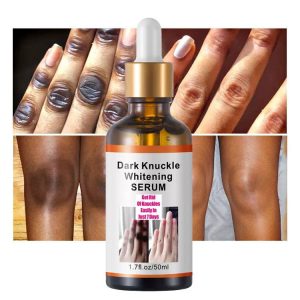 Dark Knuckles Spot Remover Serum